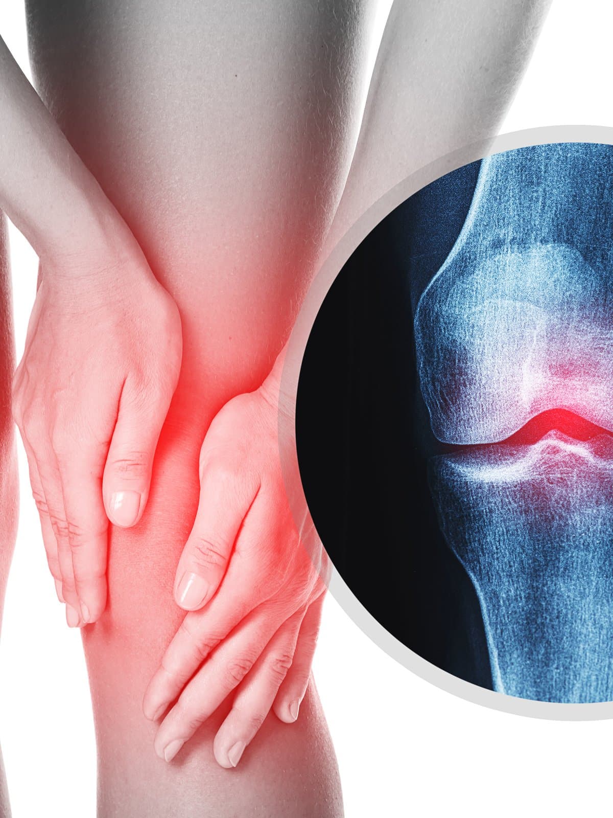 A person holding their painful knee with both hands, with an inset X-ray showing joint space narrowing highlighted in red.