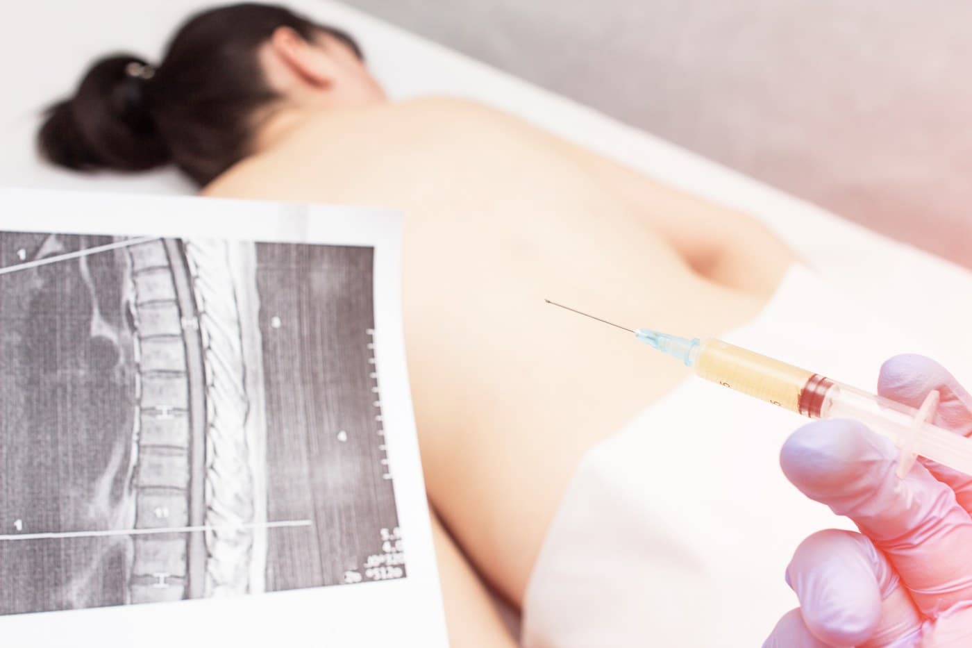 A physician holding a printed spine image alongside a prepared syringe, with the patient positioned prone on the table.